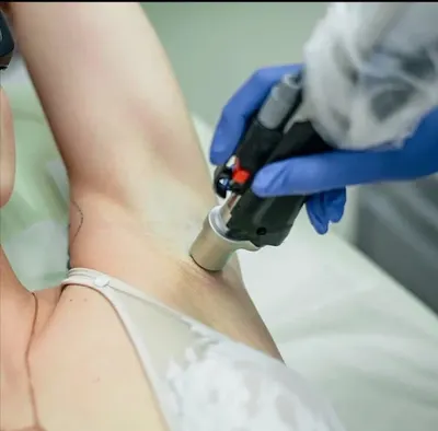 Perfect Skin - Medycyna Estetyczna i Depilacja Laserowa